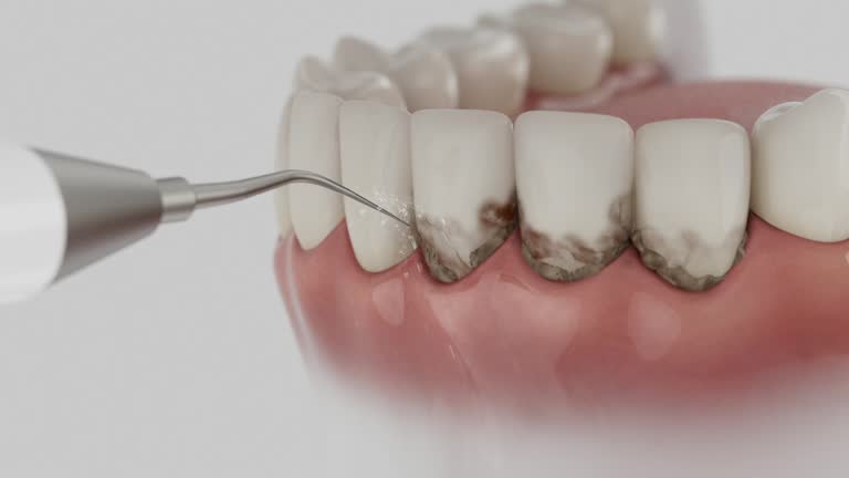 Trusted Root Canal Treatment service in Tatum, TX - Dentist Open Now
